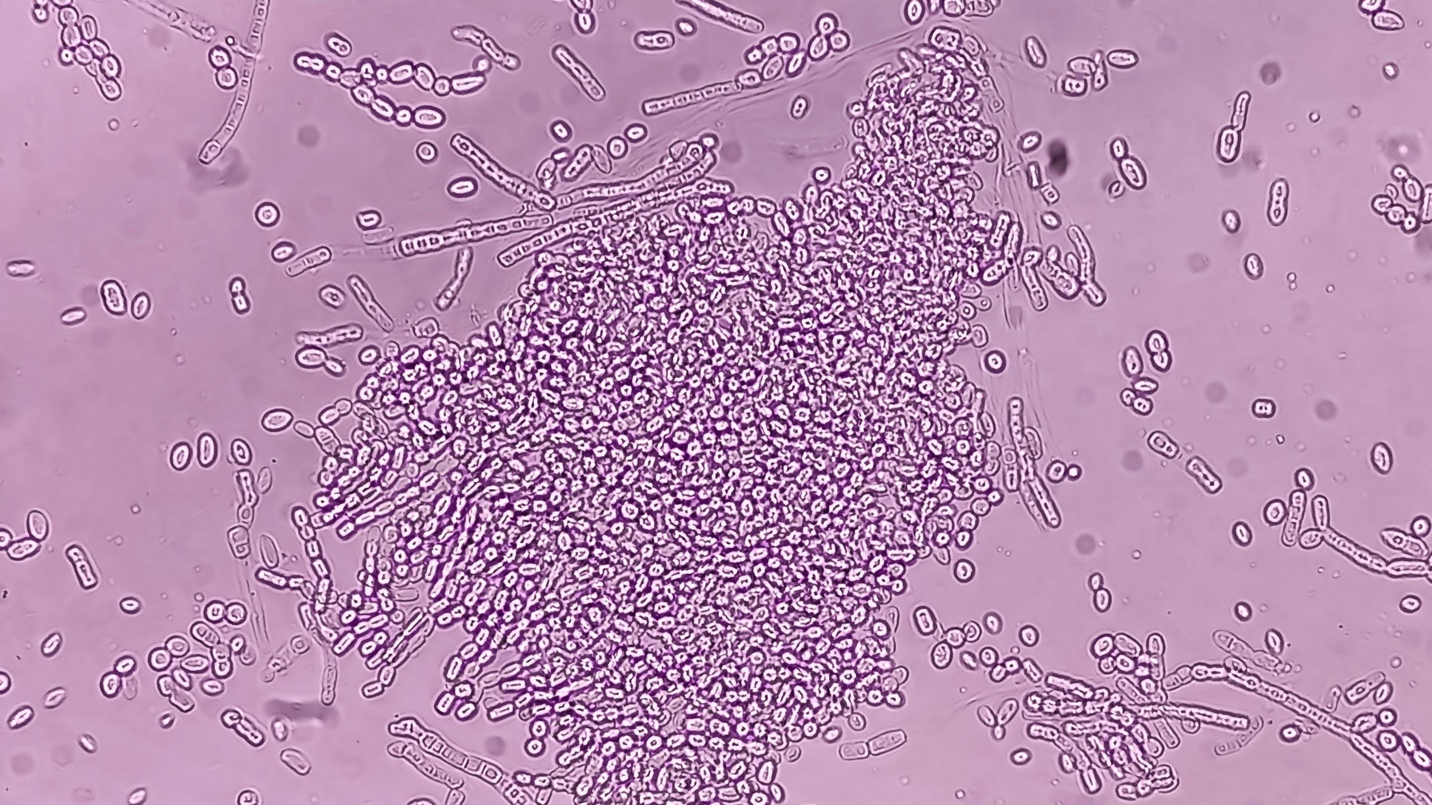 Malassezia: The Yeast of Your Problems - OCHRE