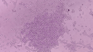 Malassezia: The Yeast of Your Problems - OCHRE